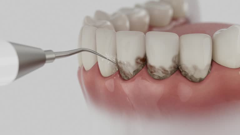 Reliable Tooth Extraction contractor in Central High, OK by Smile Center Dentistry